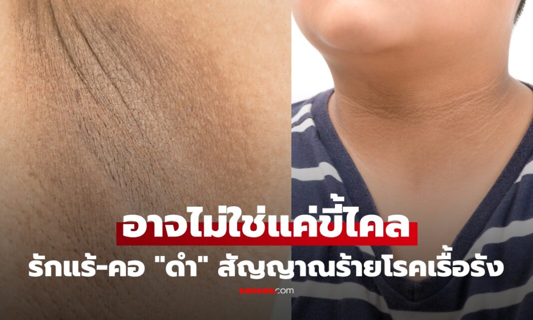 1newnewnewnewnewnewnew Thumbn