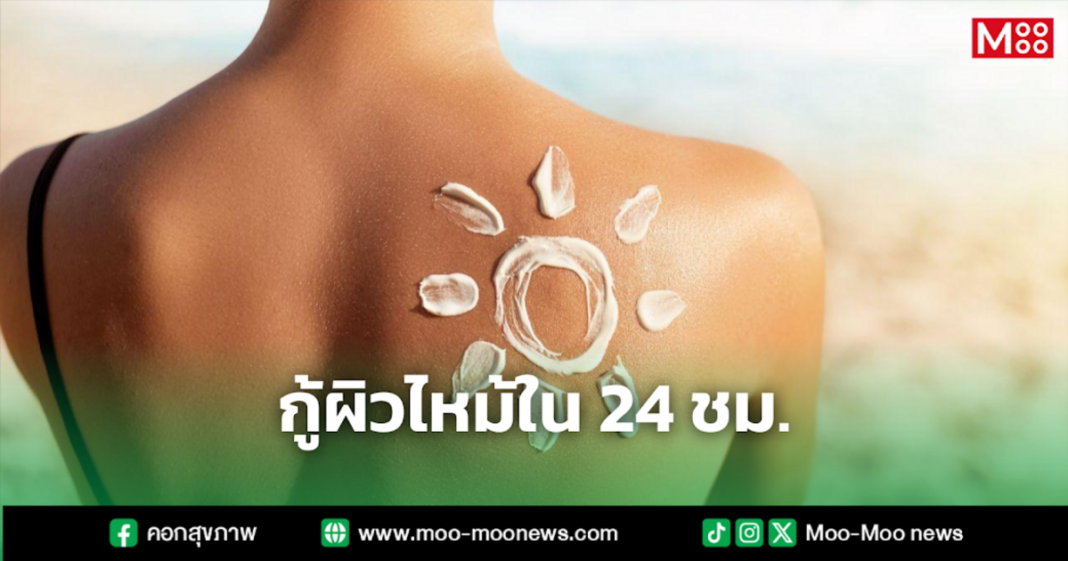 กู้ผิวไหม้ใน 24 ชม