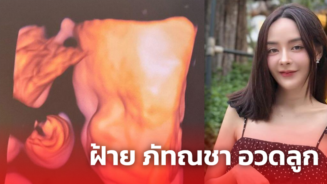 ฝ้าย ภัทณชา อวดลูก