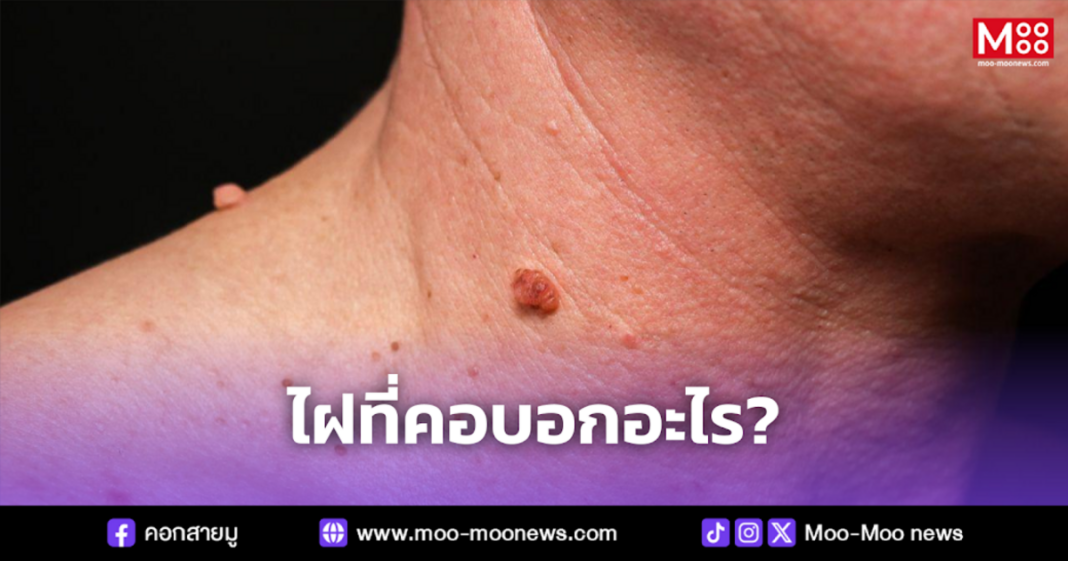 ไฝที่คอบอกอะไร